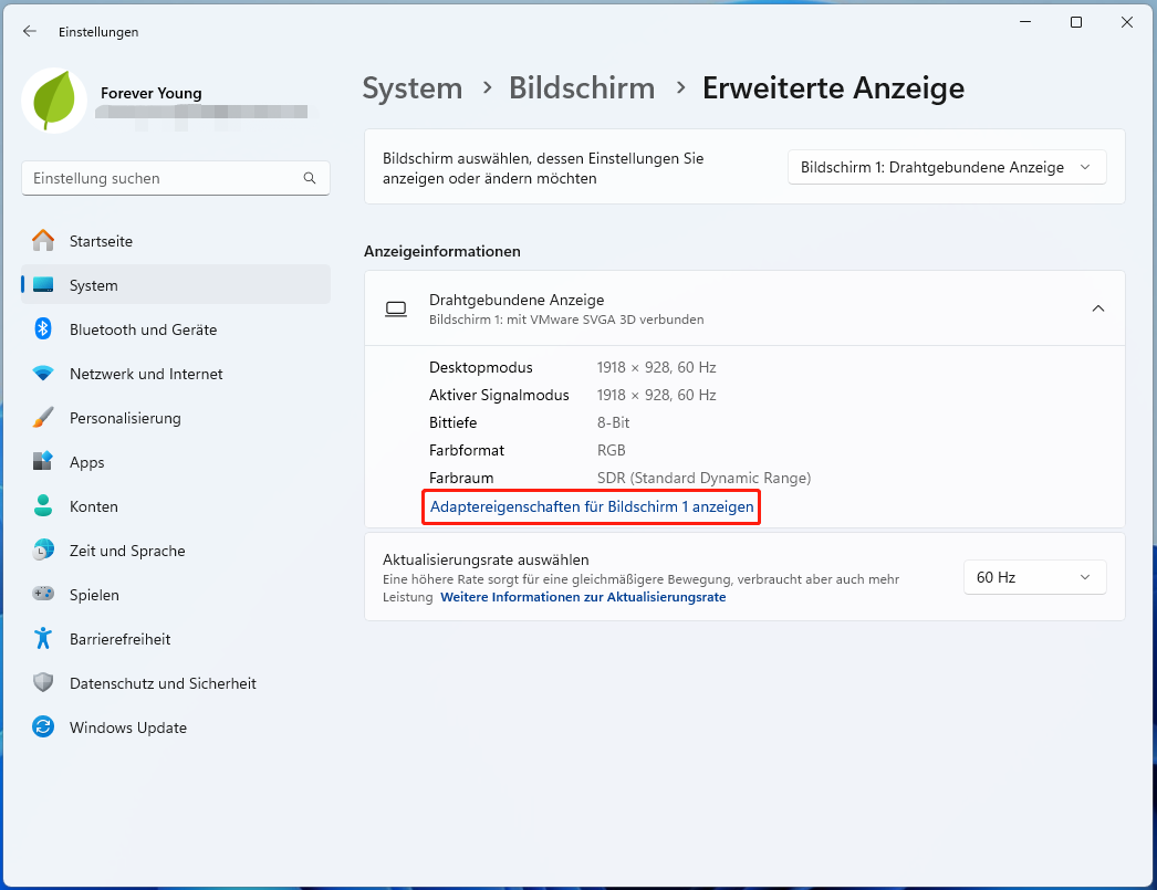 Adaptereigenschaften für Bildschirm 1 anzeigen