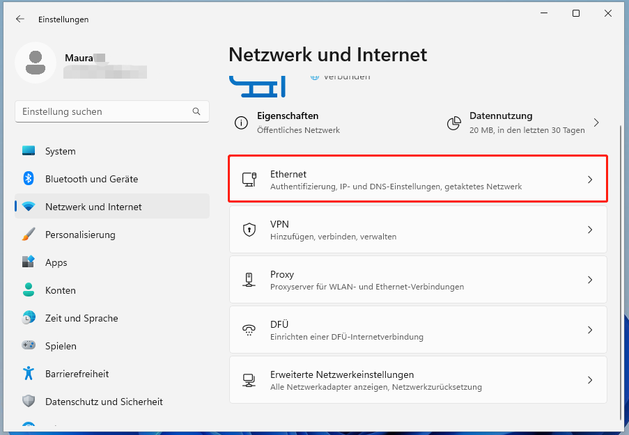 Ethernet wählen