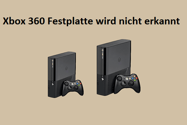 Lösungen zur Behebung von Xbox 360 Festplatte nicht erkannt