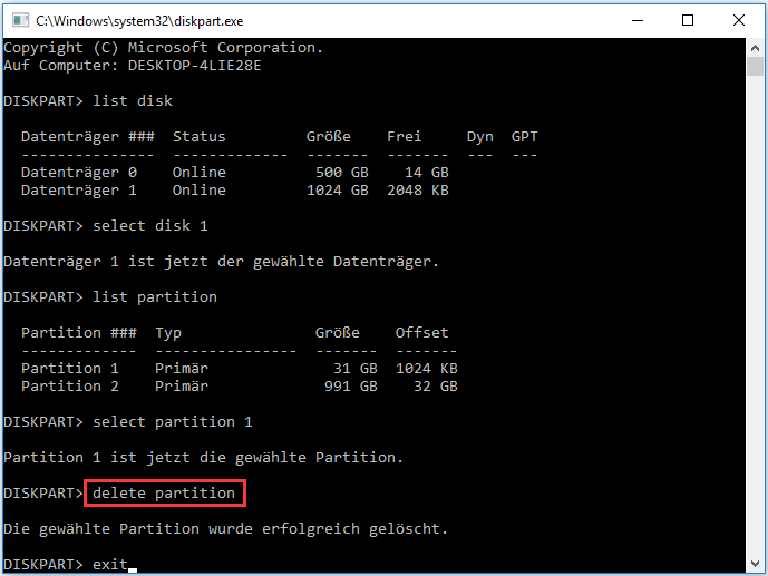 delete partition in Diskpart