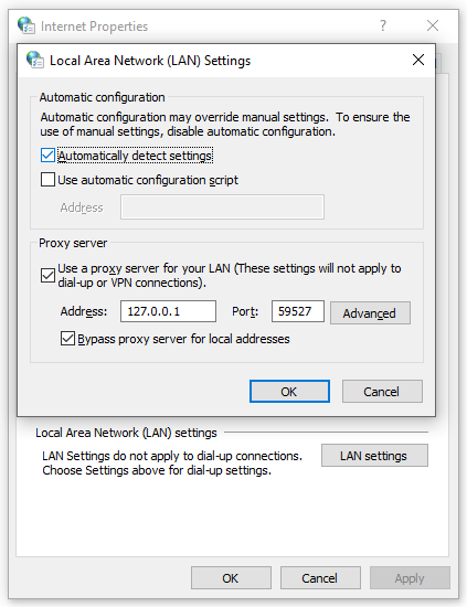 tick Automatically detect settings
