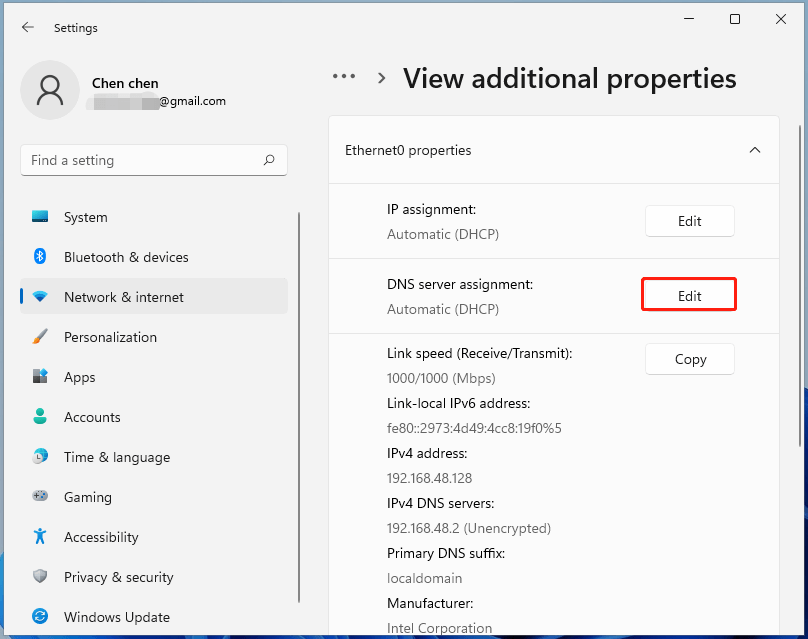 edit DNS server assignment