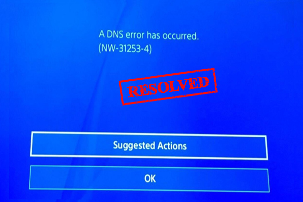How to Fix PS4 DNS Error NW-31253-4 [Simplest Methods]