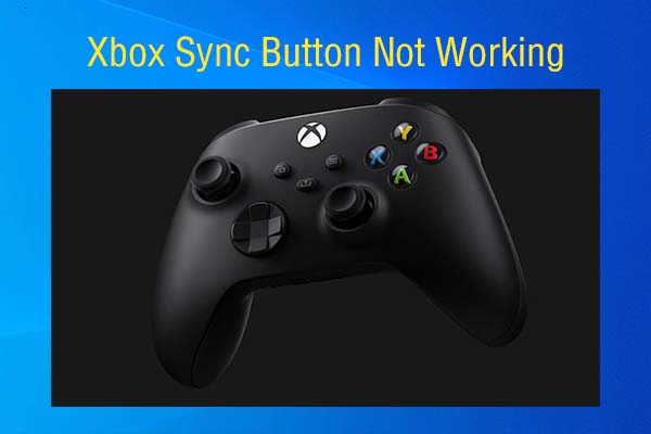 Fix Xbox Sync Button Not Working with Top 5 Fixes